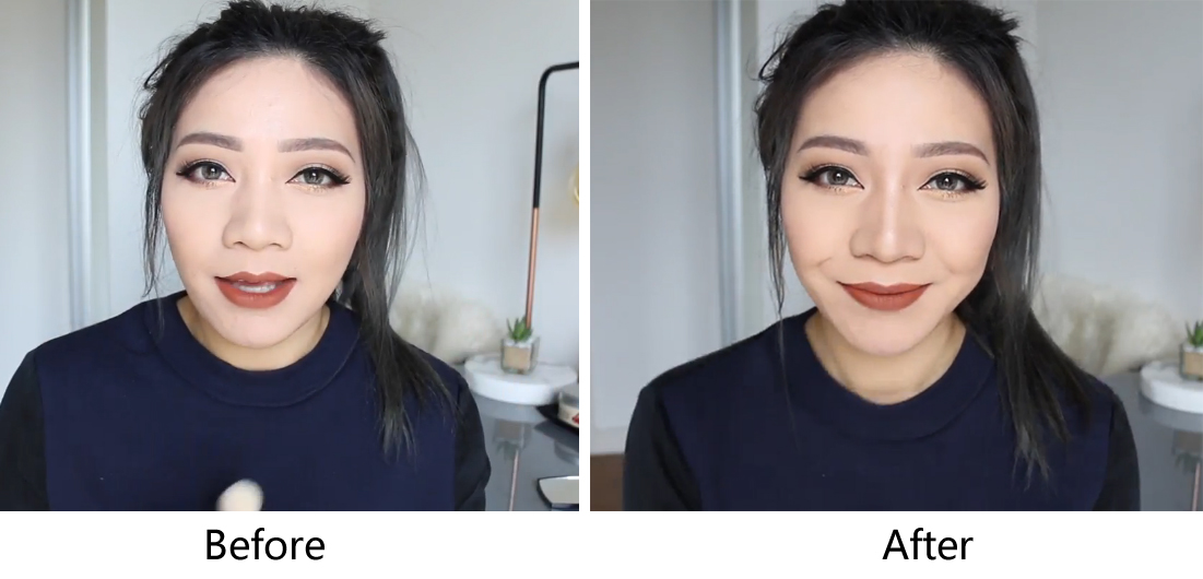 美容微整技术学习,微整变美逆袭攻略