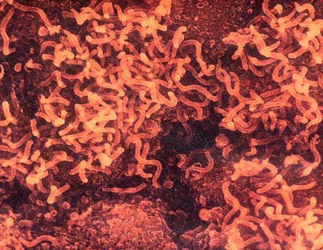 历史上的瘟疫传染病,历史上疫情持续时间最长的瘟疫