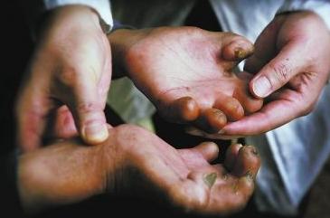 历史上的瘟疫传染病,历史上疫情持续时间最长的瘟疫