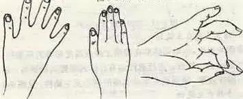 脑梗死锻炼可以恢复双腿无力么,脑梗死运动障碍