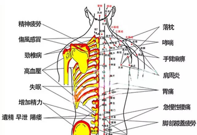 拔罐后注意事项与禁忌,你知道拔火罐用什么罐吗