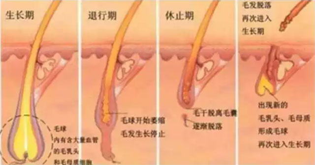 专家讲激光脱毛,激光祛斑现身说法