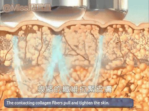 专家来告诉你美容仪真的管用吗,美容仪真的有用吗运用了哪些原理