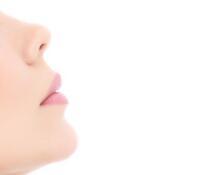 做过线雕隆鼻还可以做鼻综合不,线雕加玻尿酸隆鼻后期副作用