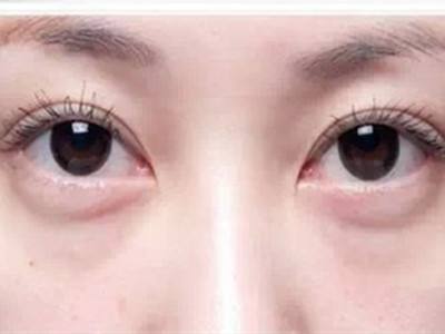 去眼周细纹最好眼霜,眼周干燥干纹用什么眼霜