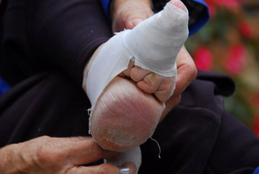 一个在古代都认为性感的东西，现今彻底消失了，对女性实在太残酷