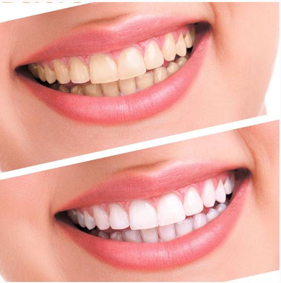 如何延长牙齿的寿命,怎么缩短牙齿生长速度