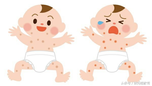 儿保专家:11种婴幼儿湿疹治疗法,家长必读