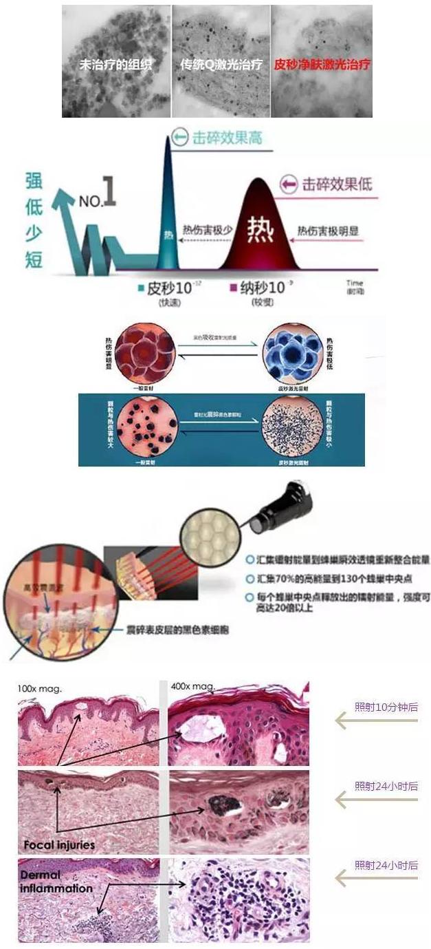 韩辰整形医院武汉光子嫩肤,南京韩辰整形皮肤科电话