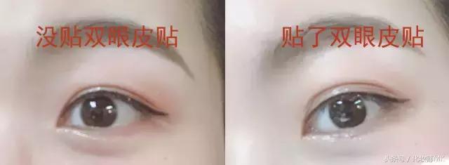 真实贴双眼皮贴,单眼皮怎么贴第二天变双眼皮