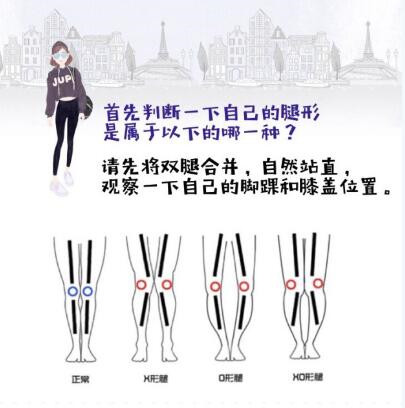 腿不直，是可以矫正的！据说坚持坚持两周就有效！小编亲测有效