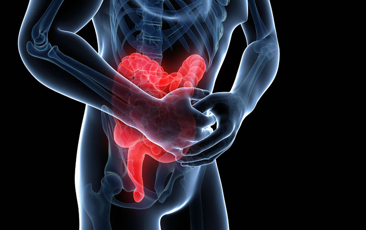 西红柿营养师,西红柿对胃不好的人能食用吗