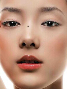 脸上有痣很难看要不要去点掉呢,脸上痣变美