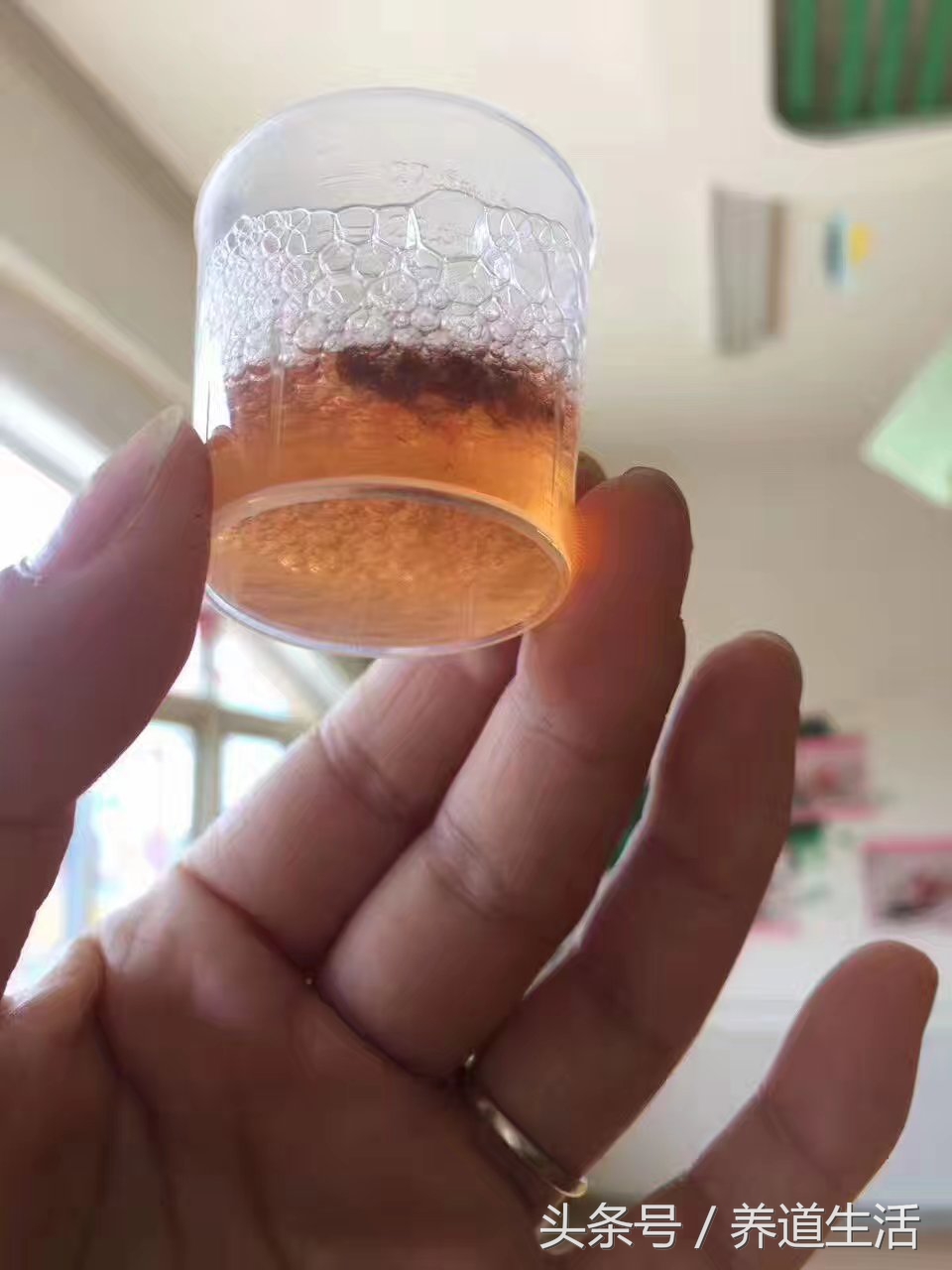 拔智齿打麻药注意左大脑有点跳动,治牙经常打麻药对大脑有损伤吗