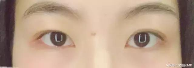 真实贴双眼皮贴,单眼皮怎么贴第二天变双眼皮