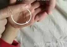 宝宝口臭就是上火了吗,宝宝口臭是因为鼻子不通气吗