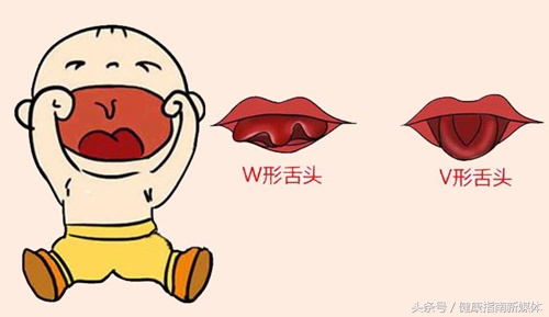 小孩舌头能伸出来是舌系带短吗,舌系带短孩子平翘舌不分怎么办