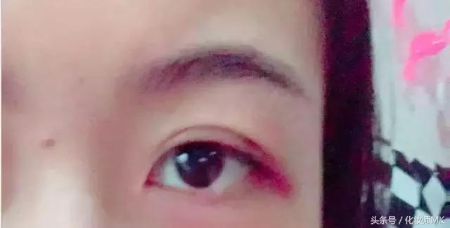 真实贴双眼皮贴,单眼皮怎么贴第二天变双眼皮