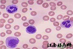 必看超全的临床常用化验单解读,手把手教你看懂医院化验单