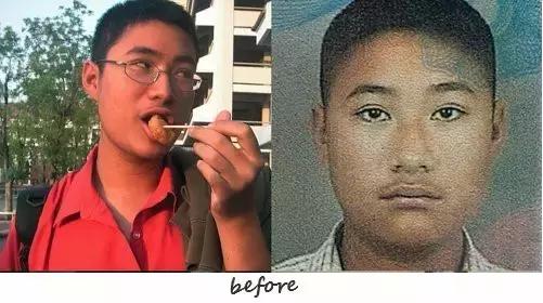 越来越多的男性整形,男士整容变帅案例