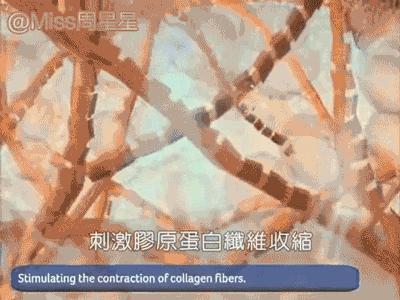 射频美容仪中的LV和香奈儿,Stop和NEWA选哪个?