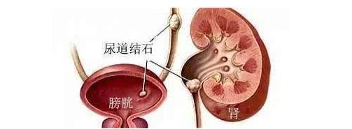 怀孕前腰疼没治好怀孕了有影响么,怀孕前腰酸痛是什么原因呢