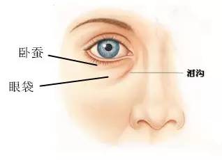 如何分辨自己是眼袋还是卧蚕,这不是眼袋这是卧蚕
