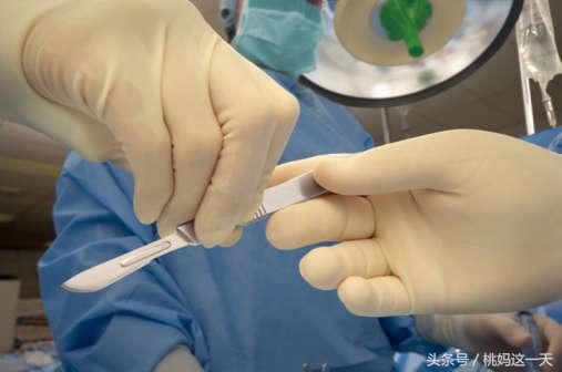 顺产vs剖宫产到底哪个好,生孩子有多痛顺产和剖腹产