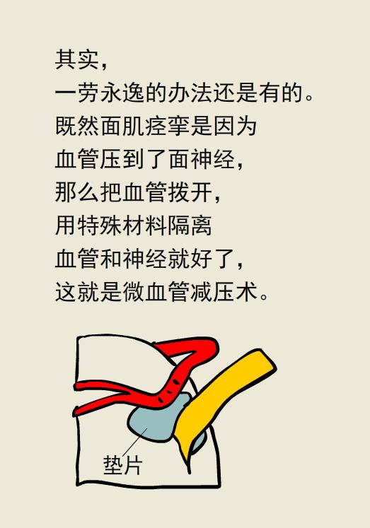 肉毒素治疗面部痉挛的副作用,肉毒素治疗痉挛危害