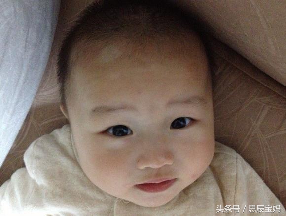 怎么判断宝宝肚子里有虫,小孩肚子有虫怎么打虫