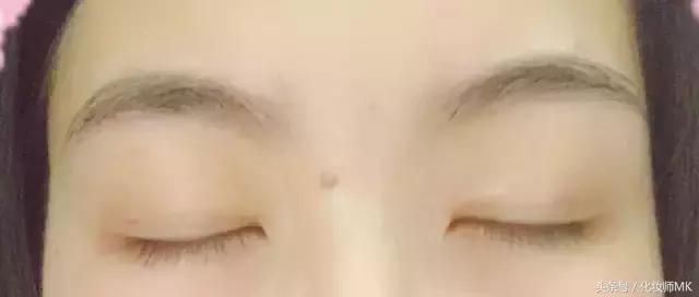 真实贴双眼皮贴,单眼皮怎么贴第二天变双眼皮