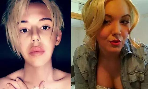 越来越多的男性整形,男士整容变帅案例