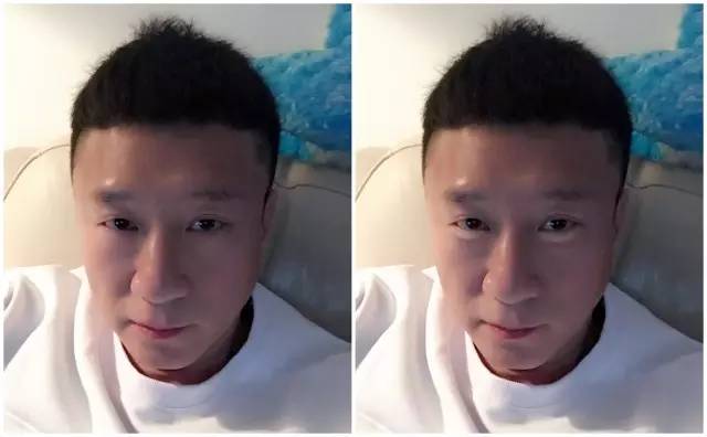 如何分辨自己是眼袋还是卧蚕,这不是眼袋这是卧蚕