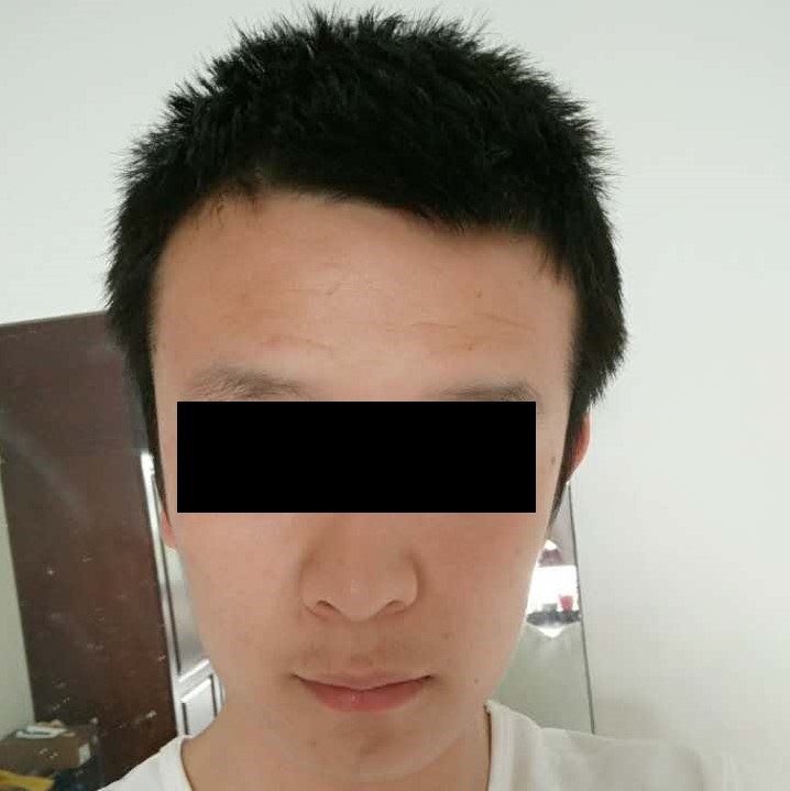 男生头发两边太炸怎么办,男生发型两边太炸怎么办