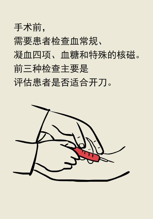 肉毒素治疗面部痉挛的副作用,肉毒素治疗痉挛危害