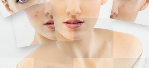 脸上有痣很难看要不要去点掉呢,脸上痣变美