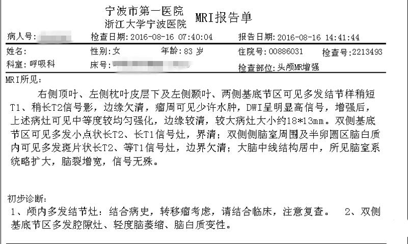 51岁抗击肺癌成功案例,80岁老人肺癌保守治疗案例