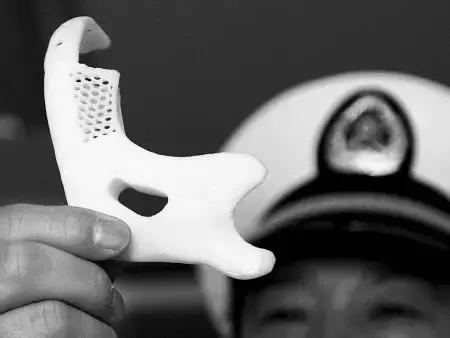 关于舌癌的新闻又一次刷屏,我想起了一年前离开的那位老人