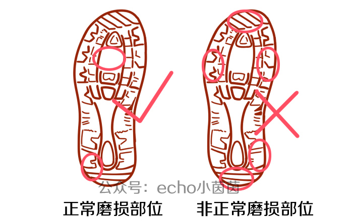 如何给宝宝鞋底防滑,宝宝鞋底磨损滑怎么办教你一招