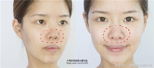 脸长嘴凸怎么办,鼻头大鼻翼宽怎么化妆改善