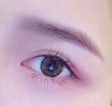 割双眼皮肉条感怎么修复消除,割双眼皮三个月了还有肉条怎么办