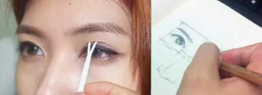 割双眼皮肉条感怎么修复消除,割双眼皮三个月了还有肉条怎么办