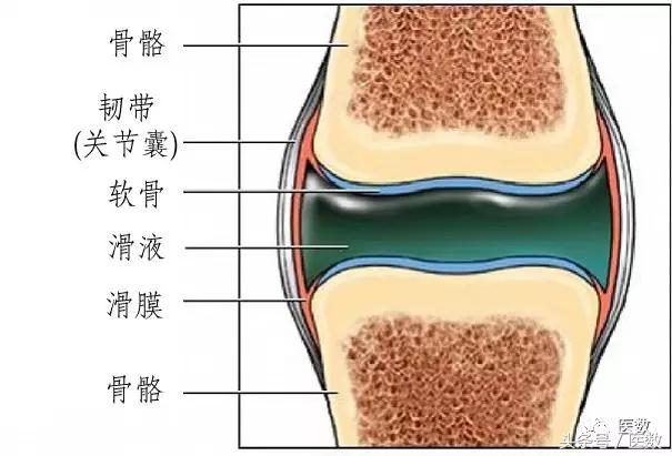 膝盖积水什么颜色,病就是什么样的