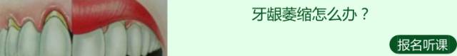 在牙科会感染艾滋病毒吗,在牙科弄牙齿会不会传染艾滋病
