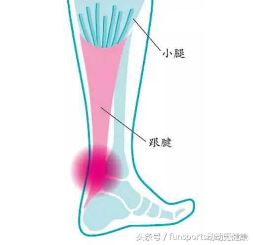 足球运动员的跟腱怎么才算合格,跟腱受伤的足球运动员