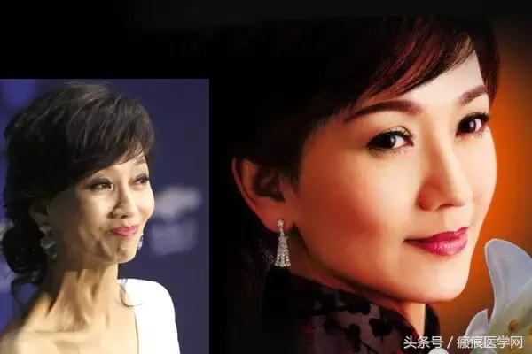 体会光的魔力，唤醒你的肌肤（很干的干货）