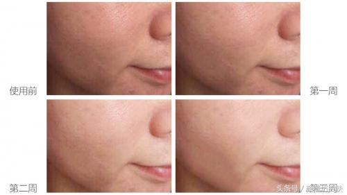 高级抗老精华,抗老精华胜肽紧致最有效果的