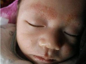 新手妈妈来围观:新生儿“胎毒”“胎垢”和胎脂到底该不该清除?