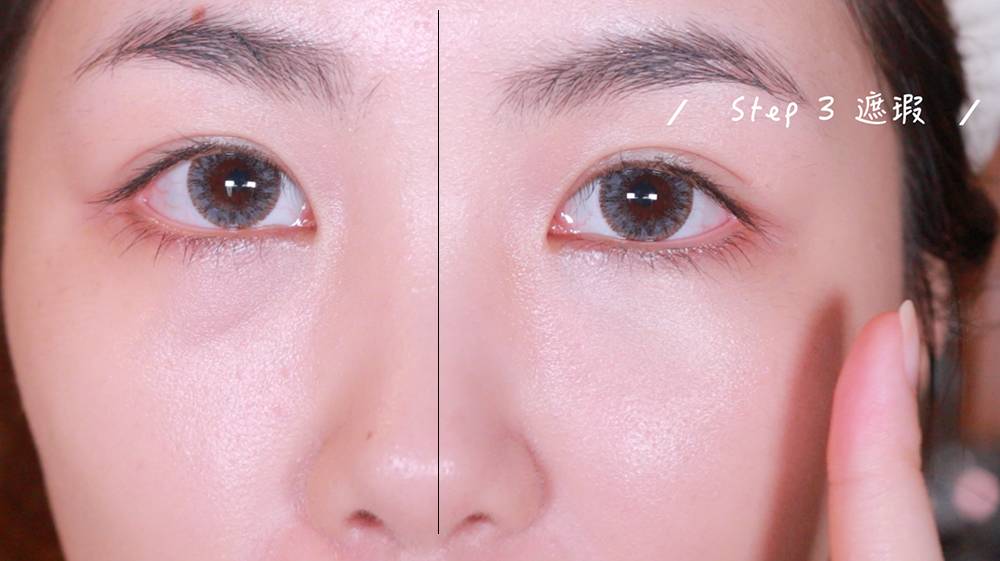 如何彻底解决黑眼圈小窍门,黑眼圈如何缓解一下就好了