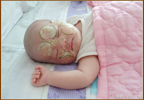宝宝长了好多痱子一直挠怎么办,宝宝长痱子很痒一直挠
